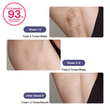 ULIKE Sapphire Air 3 IPL Hair Removal Device Without Leather Case,Purp