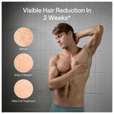 Ulike X IPL Laser Hair Removal Device, 61.4°F Ice-Cooling, Dual Lights, Skin Sensor & SHR Mode for Nearly Painless, Long-Lasting Hair Removal, 3 Modes Tailored