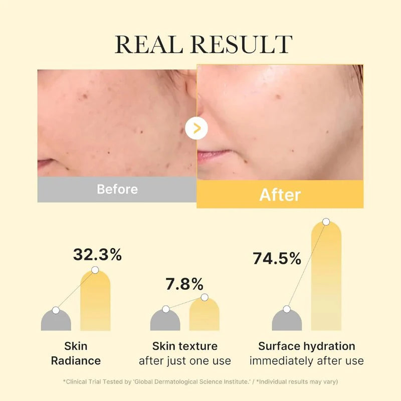 Medicube, Kojic Acid Turmeric Brightening Gel Mask, 4 Pcs