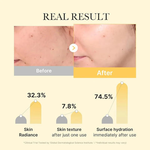 Medicube, Kojic Acid Turmeric Brightening Gel Mask, 4 Pcs