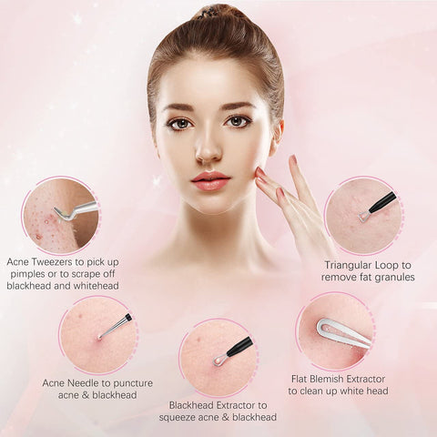 ATMOKO ELLESYE 6-Piece Blackhead Remover Tool Kit – Stainless Steel Pimple Popper Set