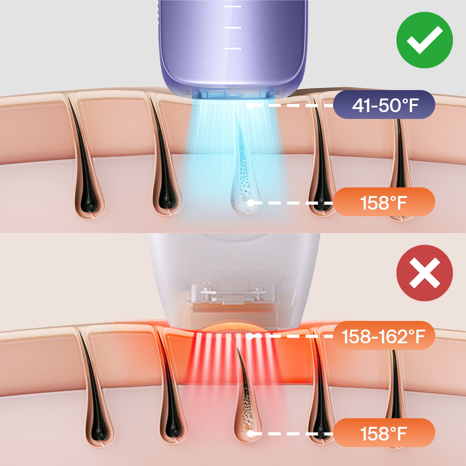ULIKE Sapphire Air 3 IPL Hair Removal Device Without Leather Case,Purp
