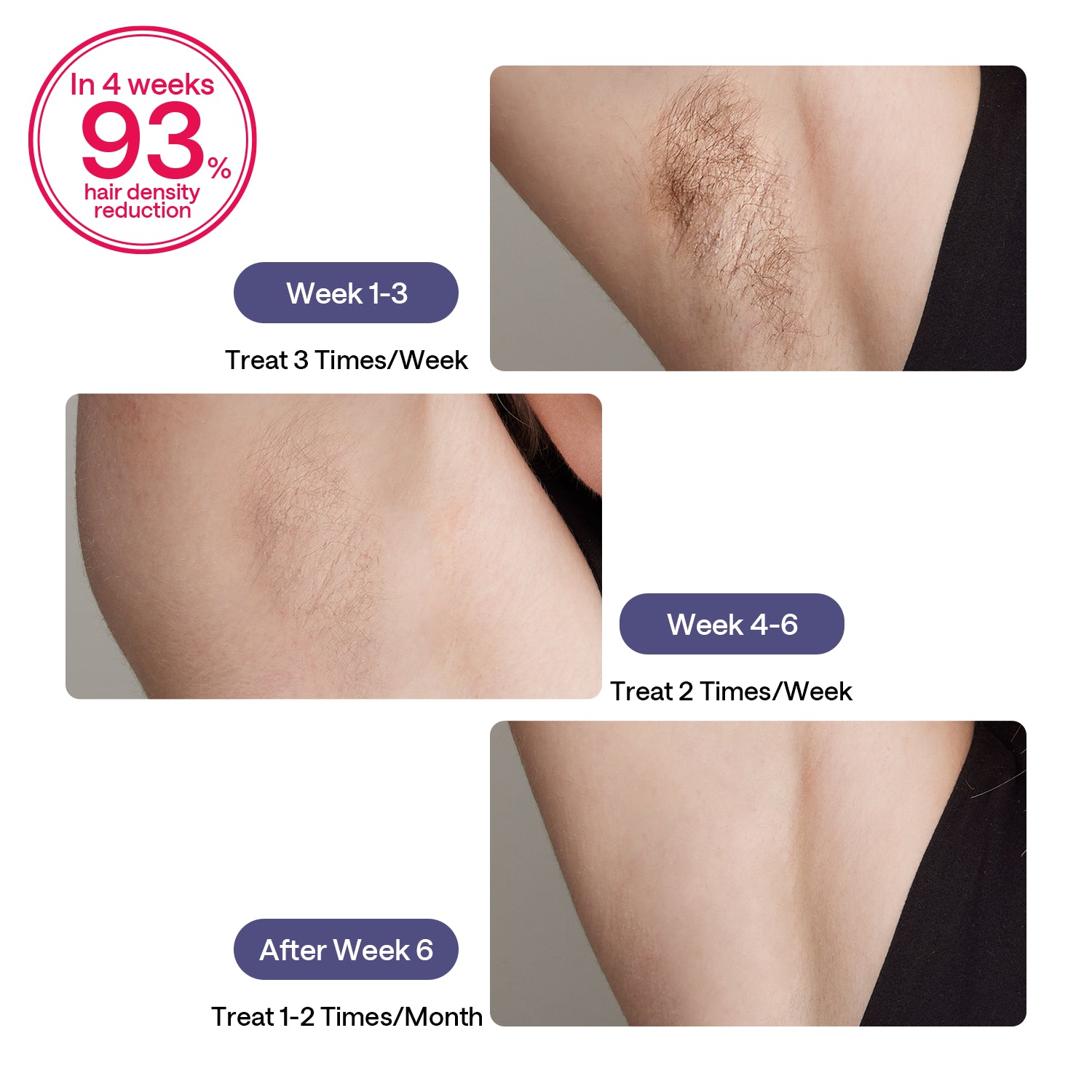 ULIKE Sapphire Air 3 IPL Hair Removal Device Without Leather Case,Purp
