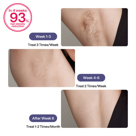 ULIKE Sapphire Air 3 IPL Hair Removal Device Without Leather Case,Purp