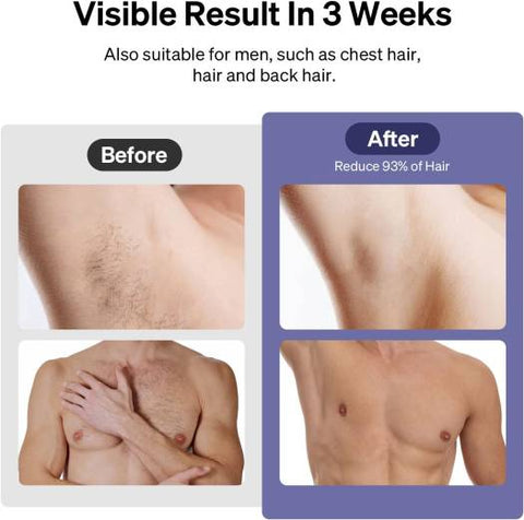 Ulike Air 3 IPL Laser Hair Removal, For Women and Men, With Sapphire Ice-Cooling System, Painless & Long-Lasting Result, Flat Head Window for Body& Face Usage, Visible Result in 3 Weeks